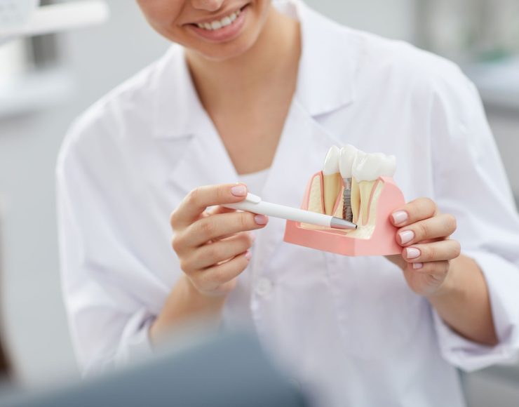 dentist-explaining-tooth-implantation-process-W4PZYA8.jpg